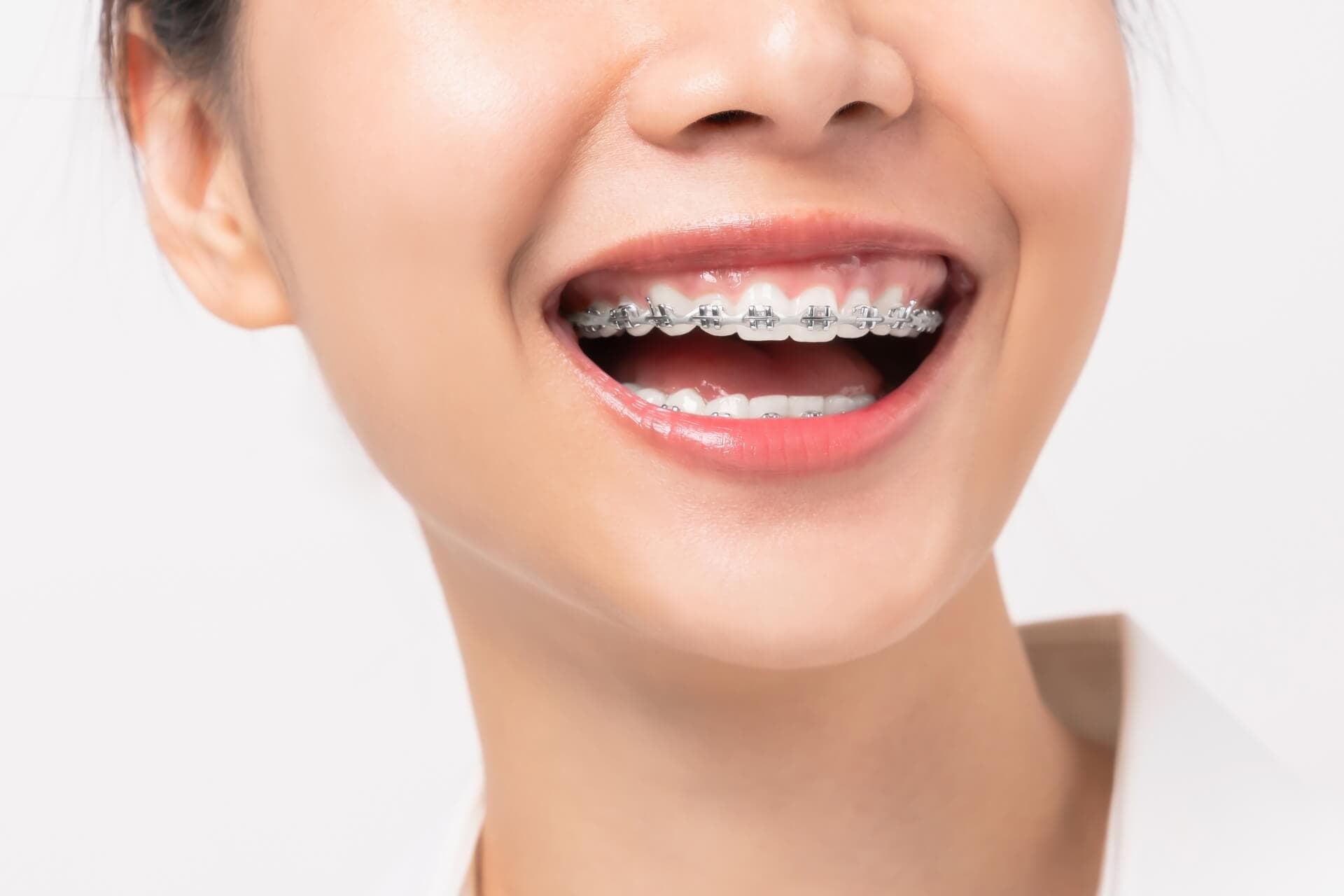 Ортодонтія